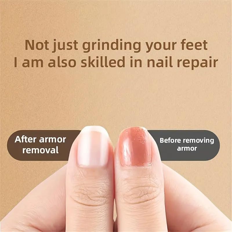 Xenos Rechargeable Callus Remover Pedicure Device for Women - Foot Scrubber for Dead Skin (pedicure machine) - LIKKA BEAUTY